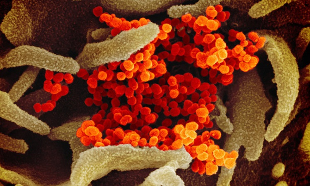 Coronavirus under the microscope